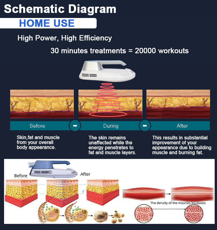 ems body sculpting device home use