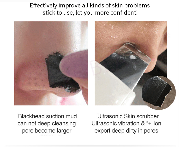 beauty ultrasonic skin scrubber