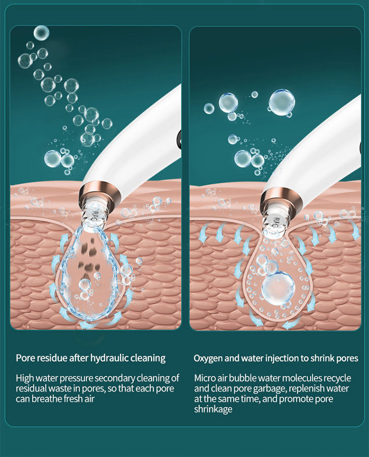 vacuum negative pressure centrifugation technology