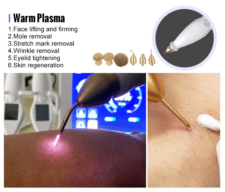 plasma pen fibroblast device