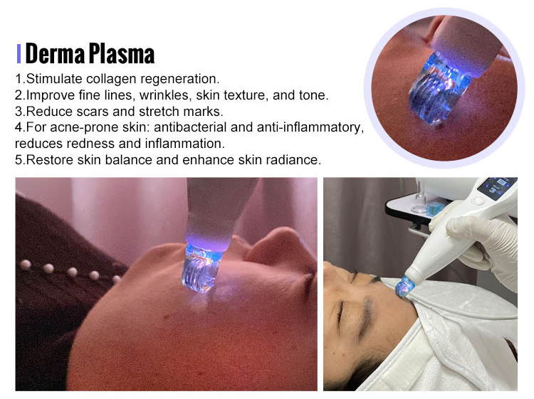 plasma pen fibroblast device